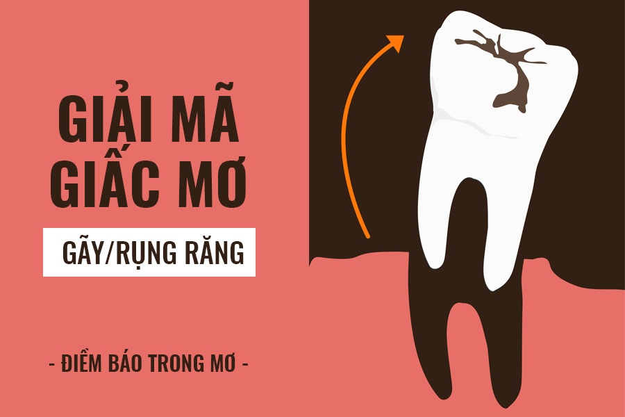 mơ rụng răng